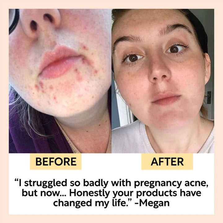 Face Moisturiser